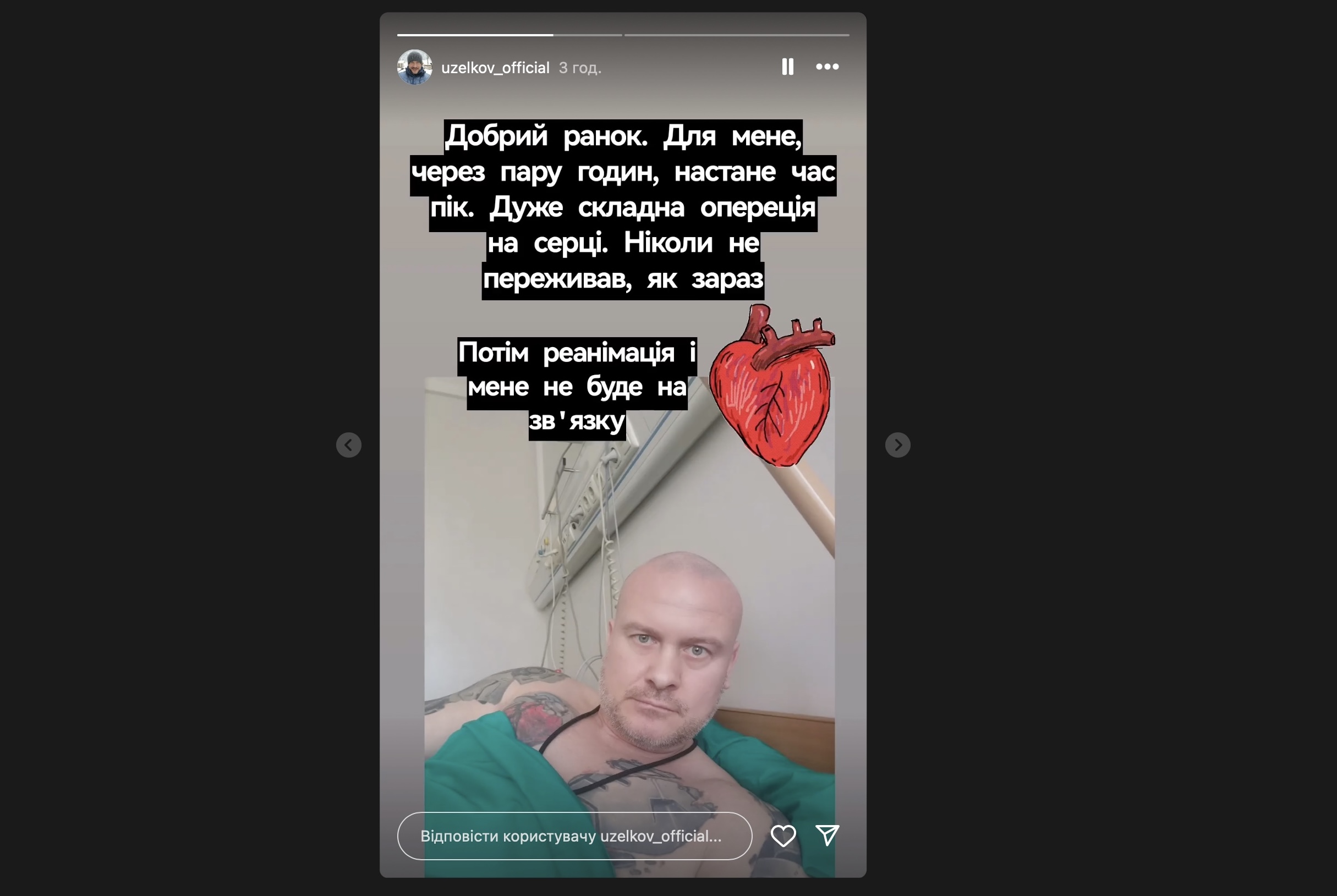 В'ячеслав Узелков розповів про операцію, на яку чекає. Фото з Instagram @uzelkov_official