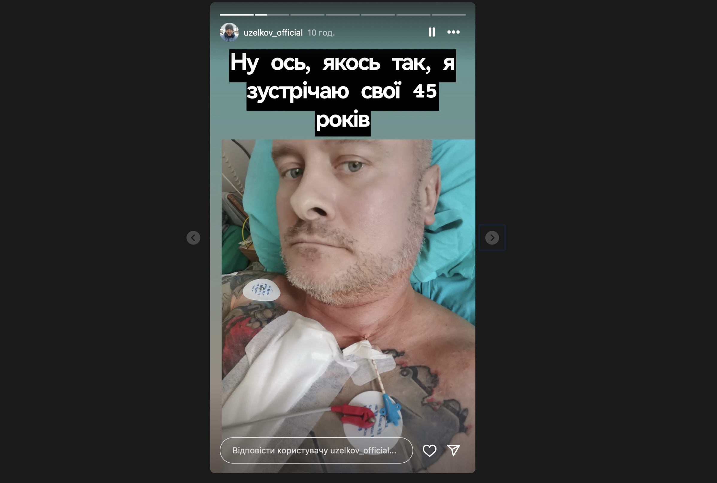 Вʼячеслав Узелков вийшов на звʼязок після операції на серці. Фото з Instagram @uzelkov_official