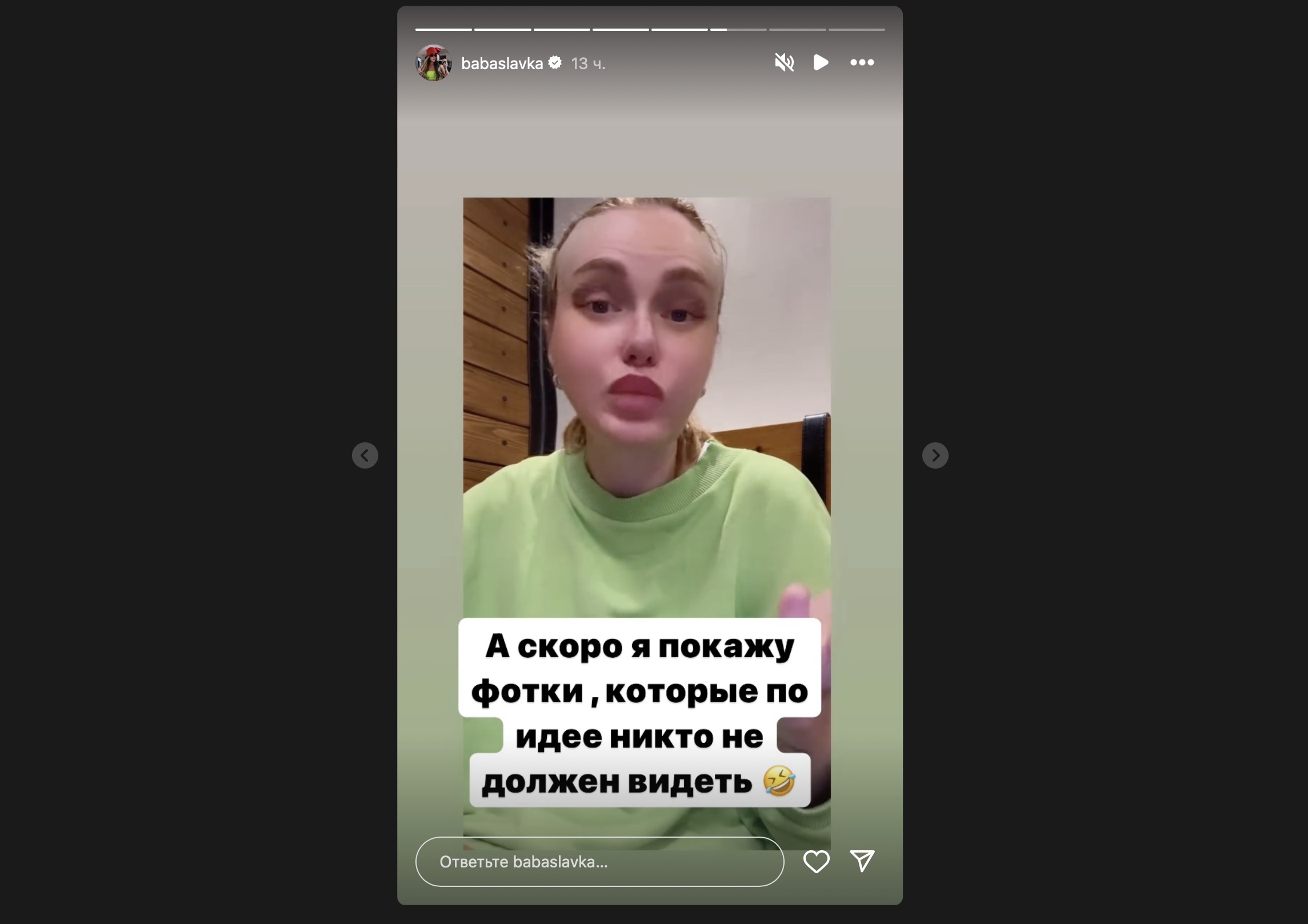 Слава Камінська вперше показала себе після чергової пластики. Фото з Instagram @babaslavka